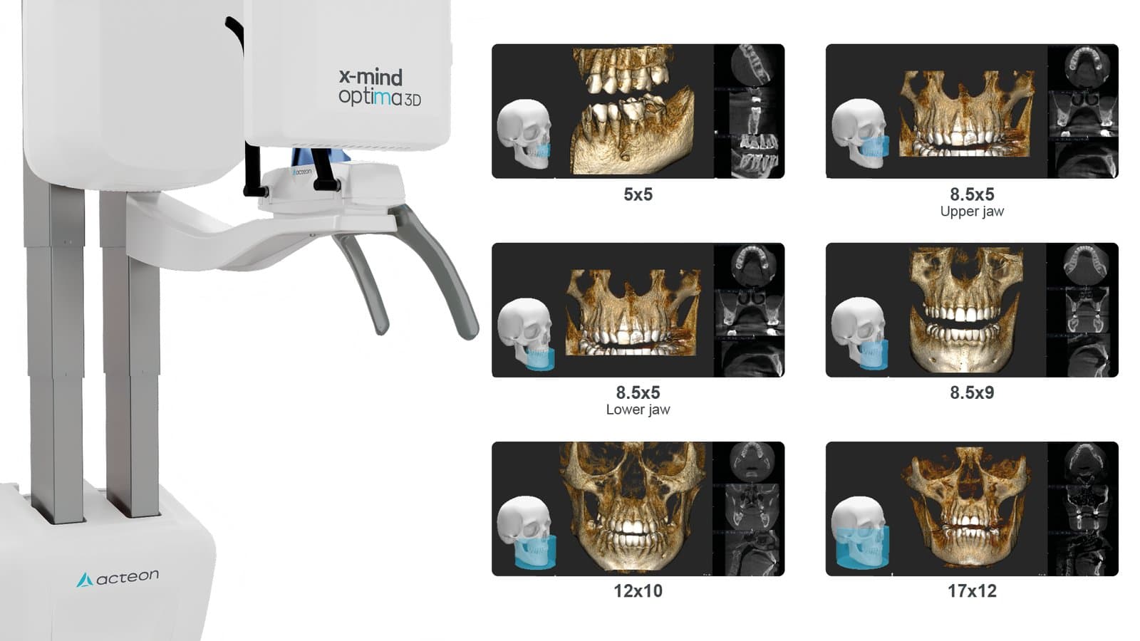 Acteon X-Mind Optima 3D görsel 1