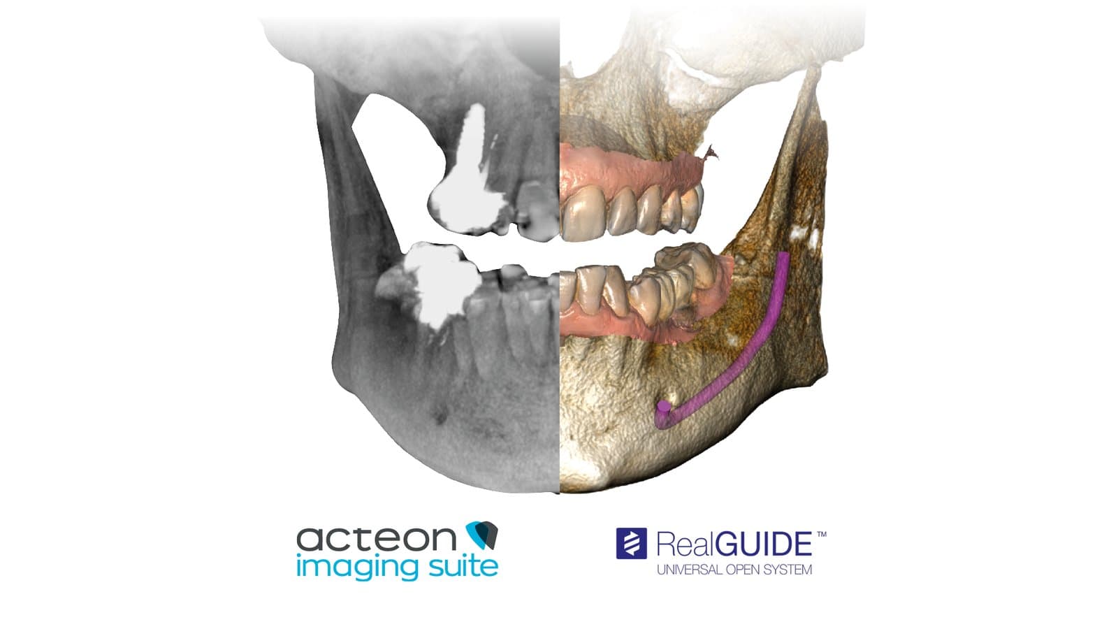Acteon X-Mind Optima 3D görsel 2